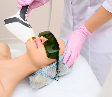Laser Photo Facial